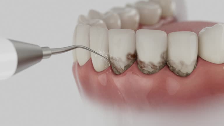 Reliable Tooth Extraction contractor in Eaton, OH by Smile Center Dentistry